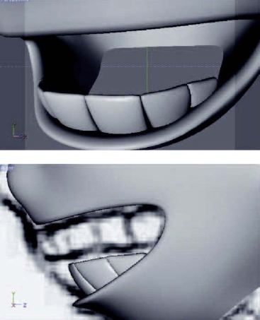 Нижний ряд зубов